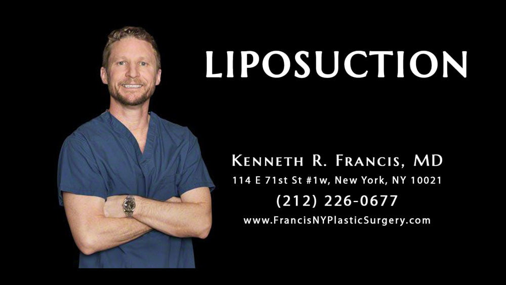 Liposuction Nyc