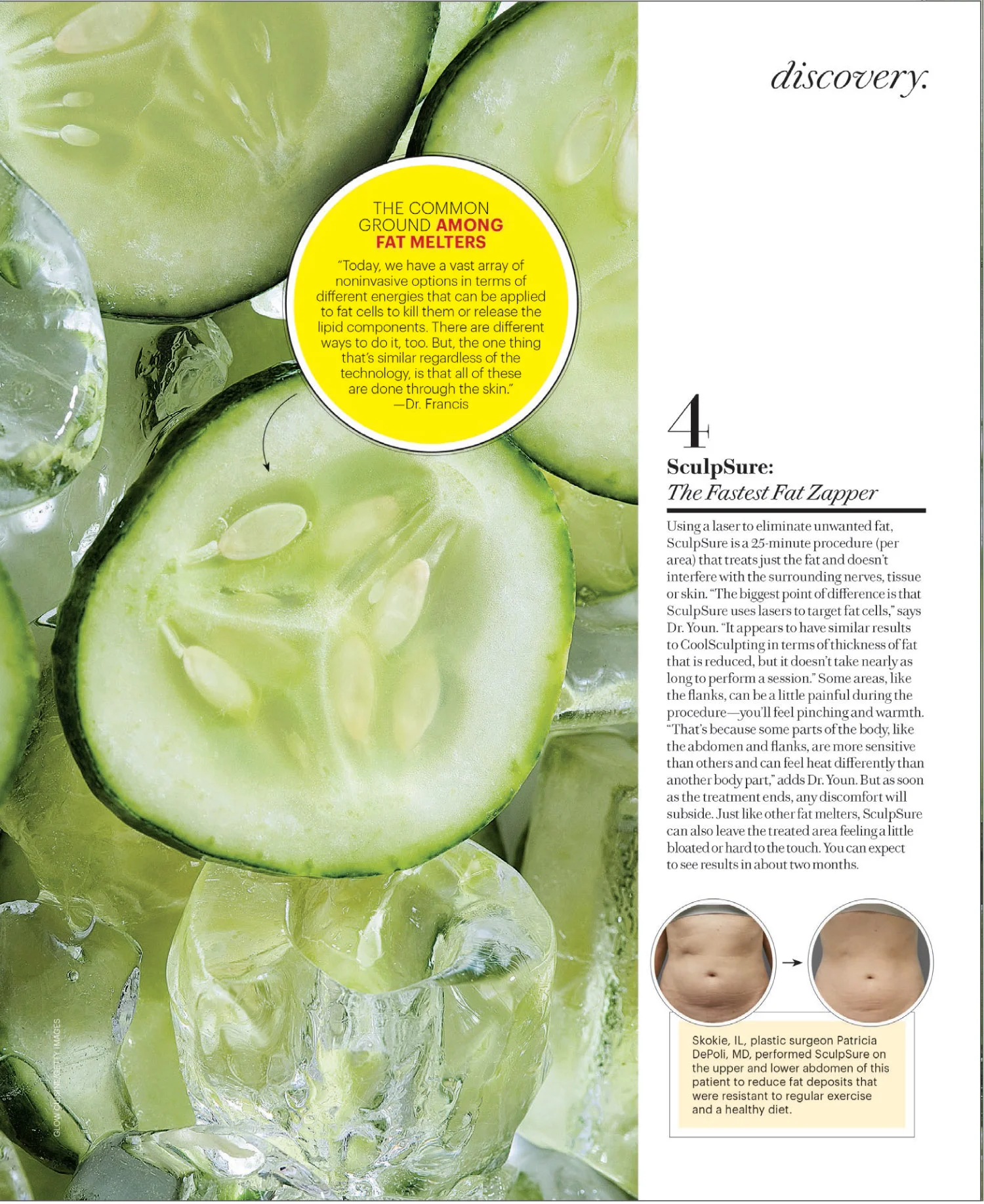 Dr. Francis is featured in this article of New Beauty January issue 4