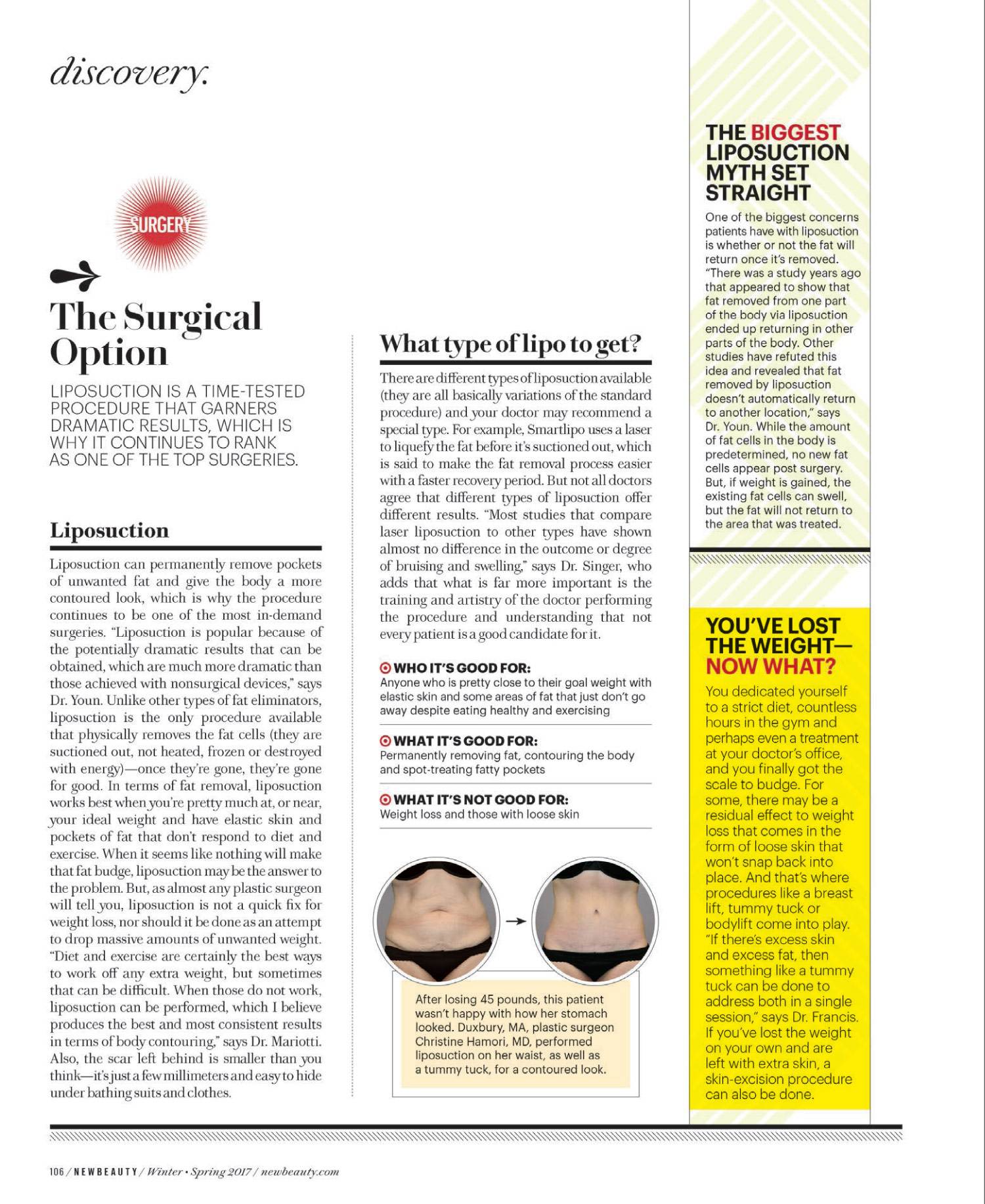 Dr. Francis is featured in this article of New Beauty January issue 5