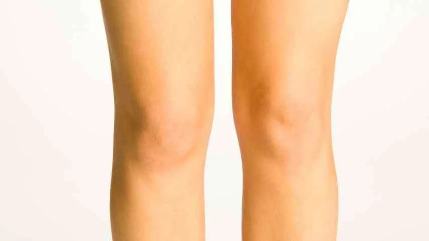 Knees liposuction NYC