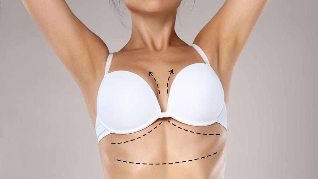Liposuction and Breast Reduction 1 Liposuction and Breast Reduction