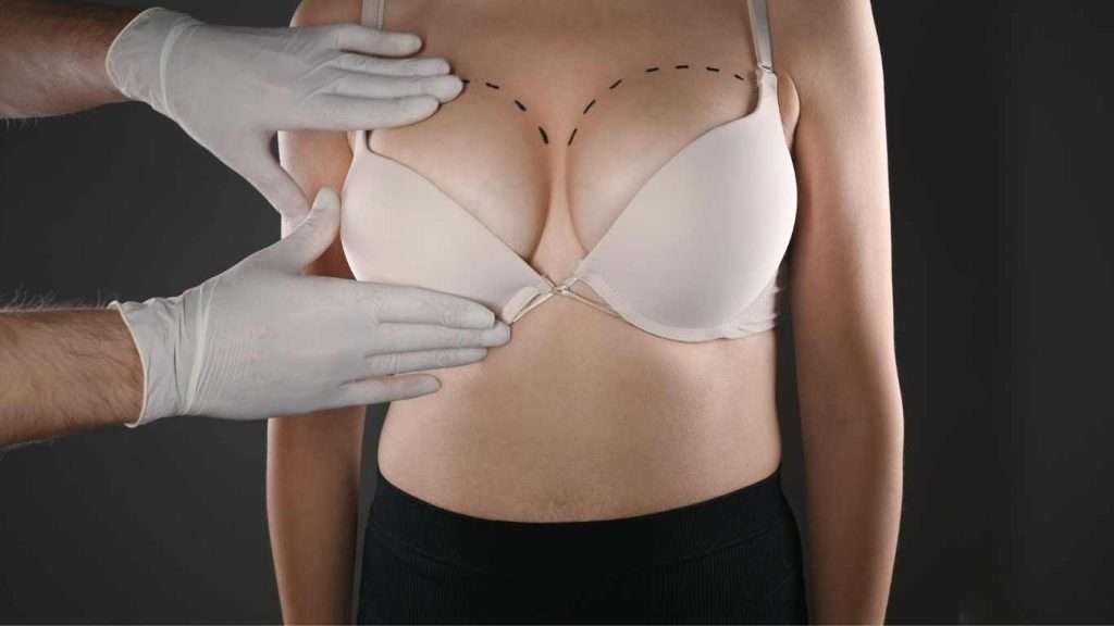 400cc breast augmentation cost NYC Archives Kenneth R. Francis