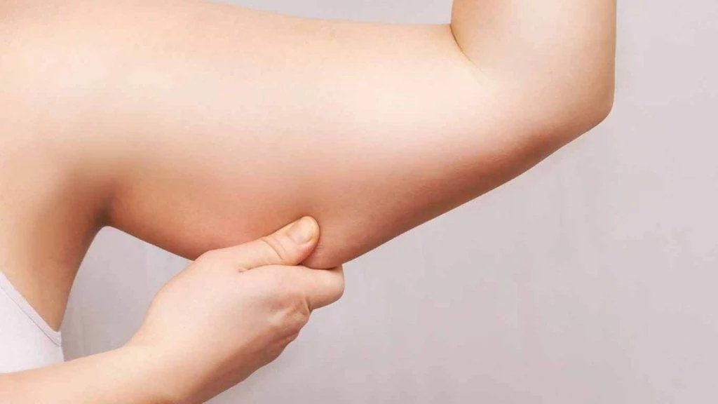Arm liposuction nyc