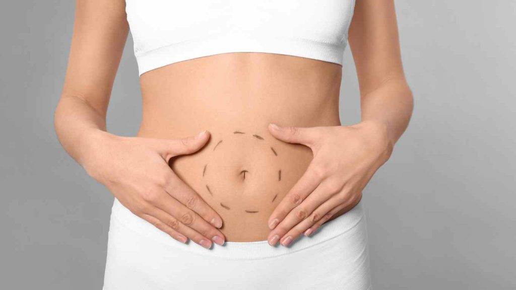 Belly button surgery nyc 1 belly button surgery nyc