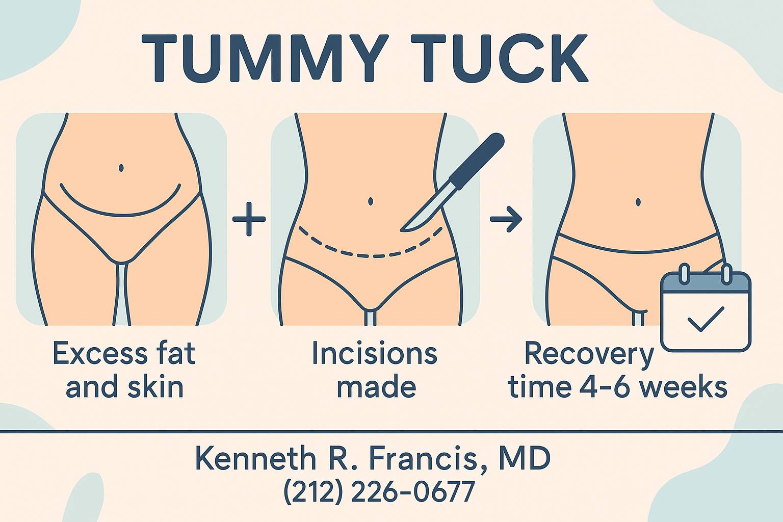 Tummy Tuck NYC by Dr. Francis Tummy tuck surgery by Dr. Francis in NYC